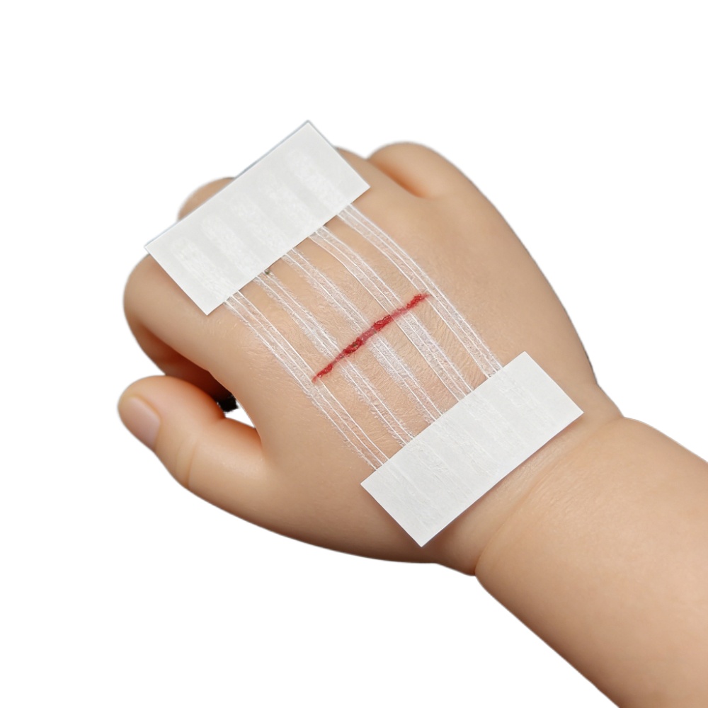 5 Strips Wound Skin Closure St - Medical Label recension och pris