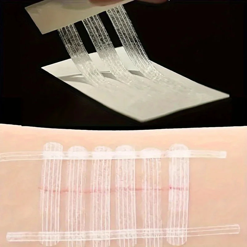 5 Strips Wound Skin Closure St - Medical Label recension och pris