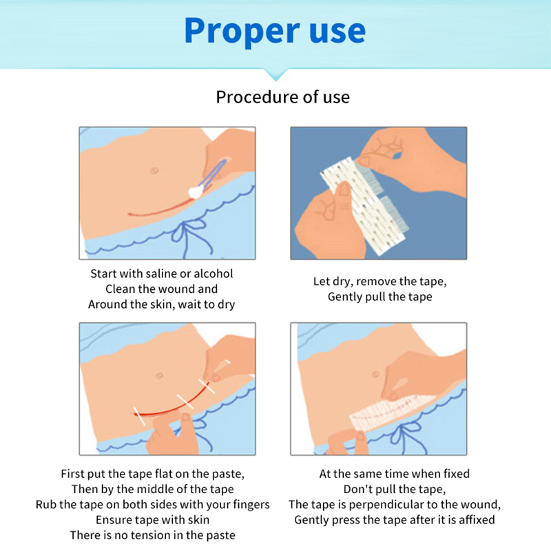 5 Strips Wound Skin Closure St - Medical Label recension och pris